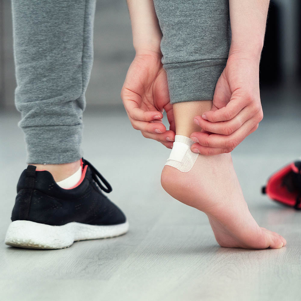 blaren, blaar verzorgen