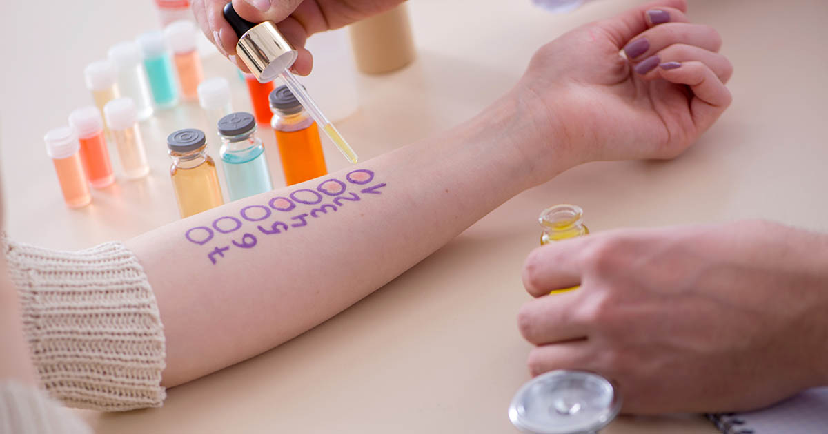 s-allergie-behandeling