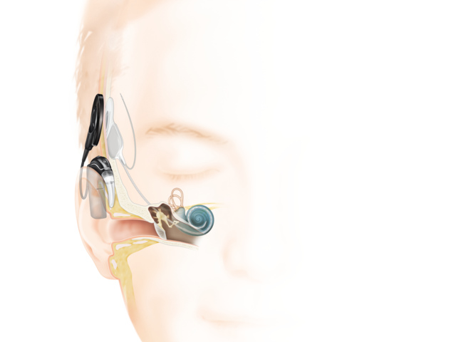 N7System_HowItWorks (3)