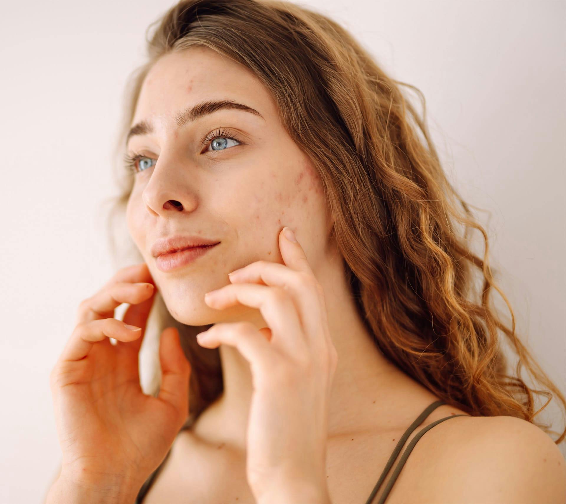 woman with blue eyes touching her face