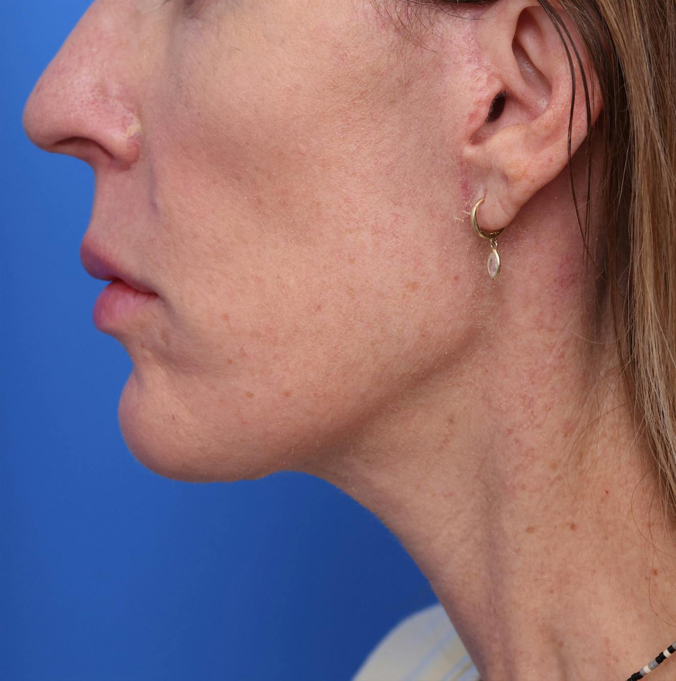 by Dr. Alex Caniglia