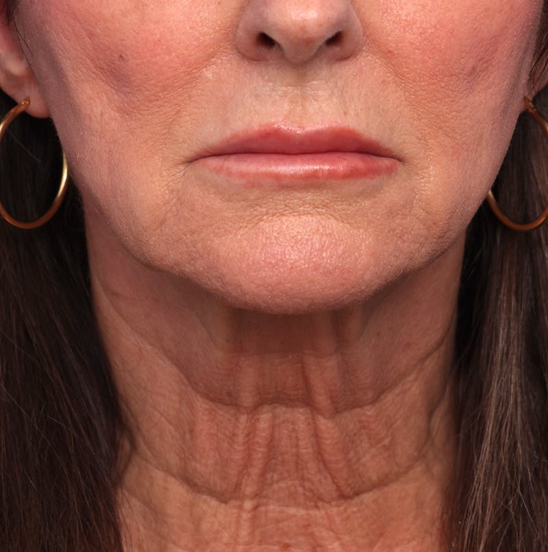 by Dr. Alex Caniglia