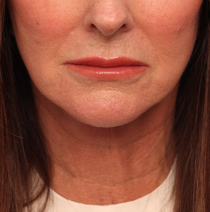 by Dr. Alex Caniglia