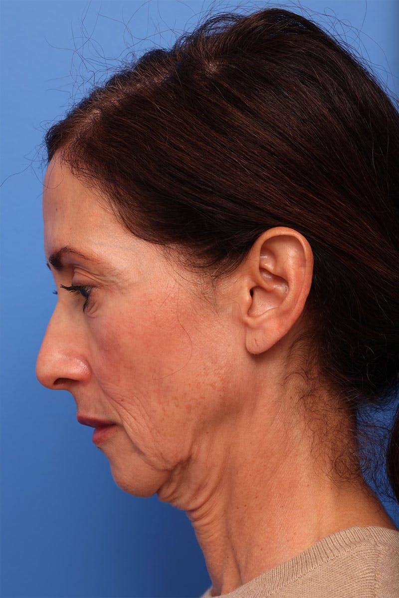 by Dr. Alex Caniglia