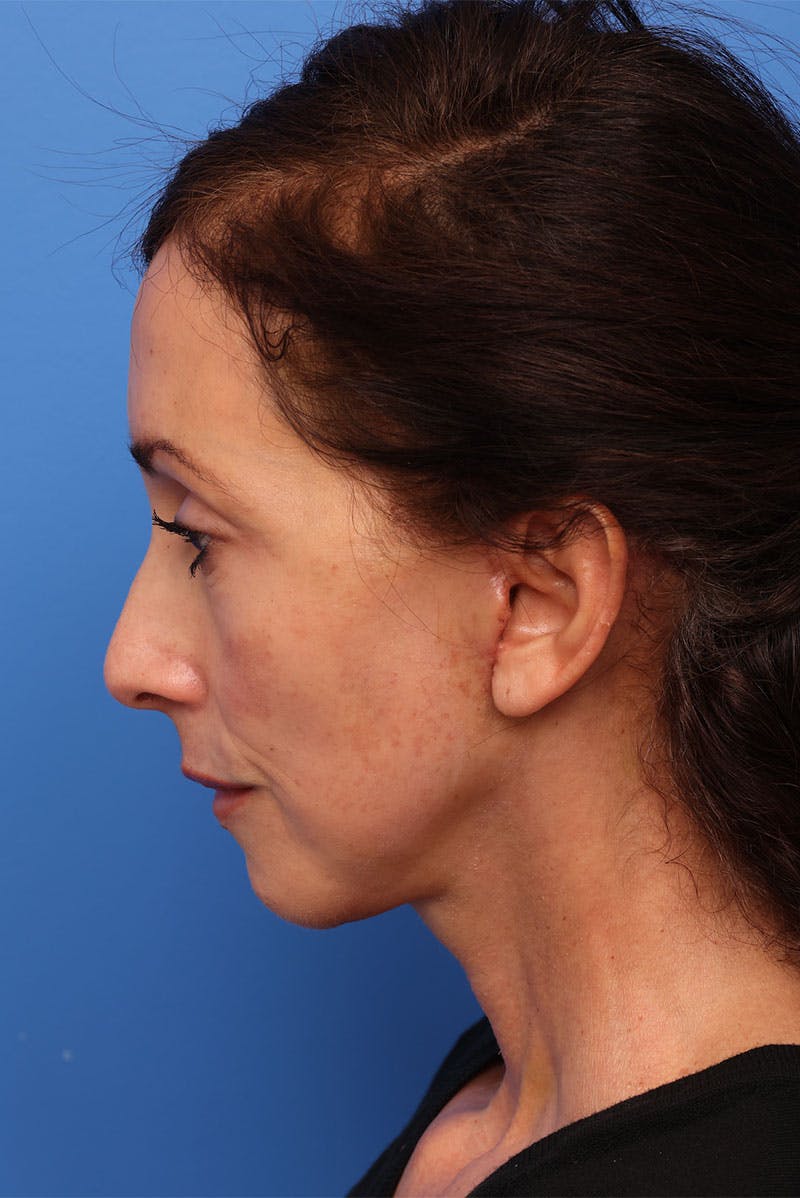 by Dr. Alex Caniglia