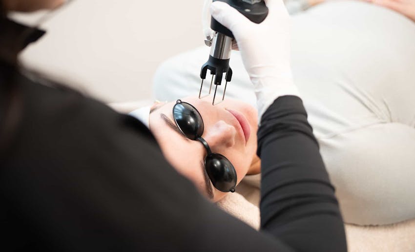 Patient during treatment