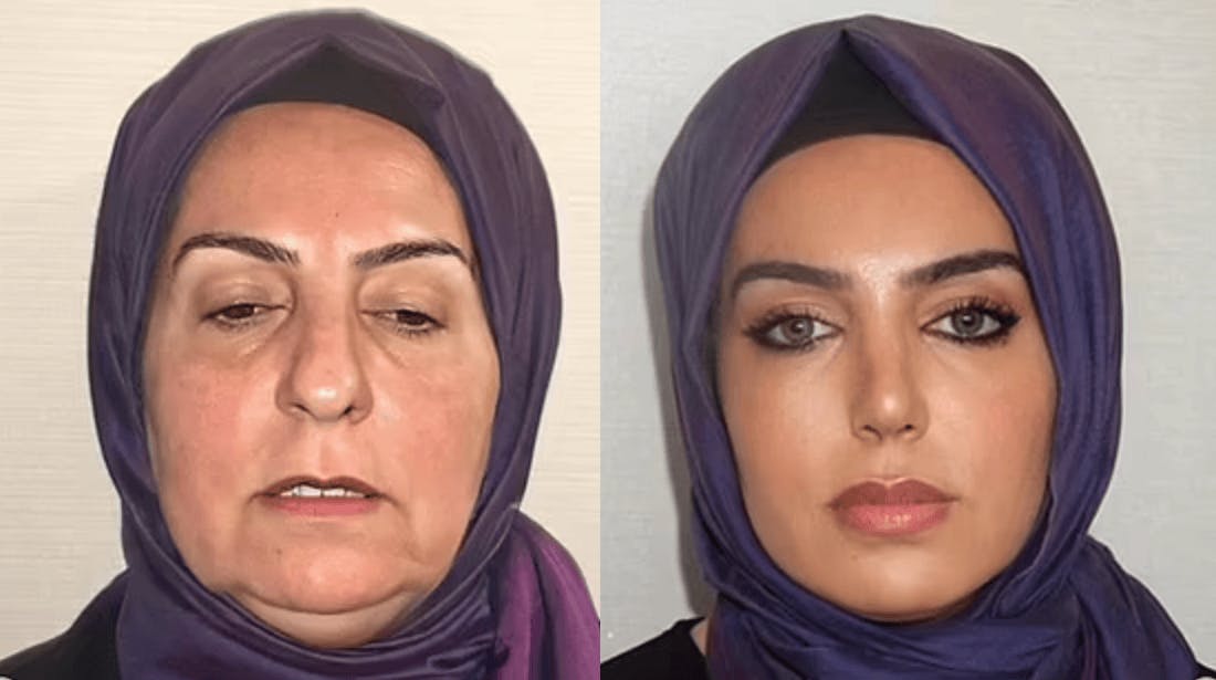 As featured in Daily Mail: Americans are traveling 6,000 miles to plastic surgery clinic known for its jaw-dropping transformations... but is the whole thing a scam? Our experts weigh in