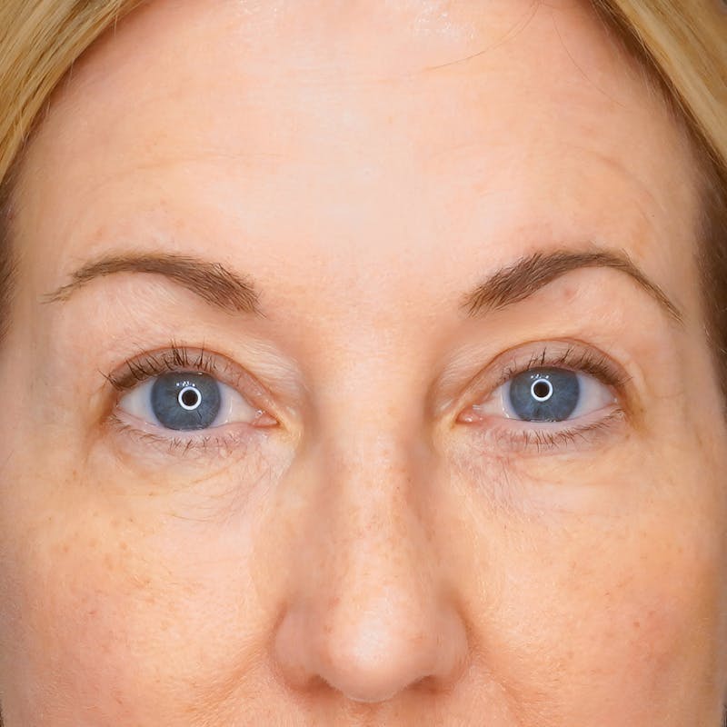 Woman's Eyes