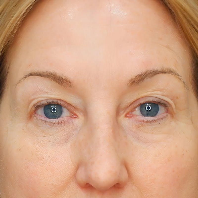 Woman's Eyes
