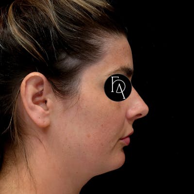 Woman's Profile