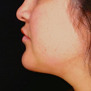 Woman's Profile