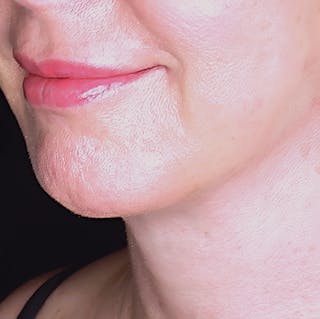 Woman's Lips