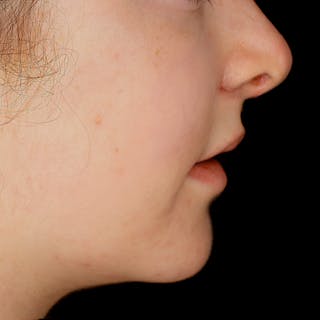 Woman's Profile
