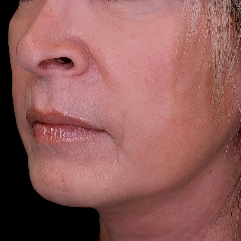 Woman's Lips
