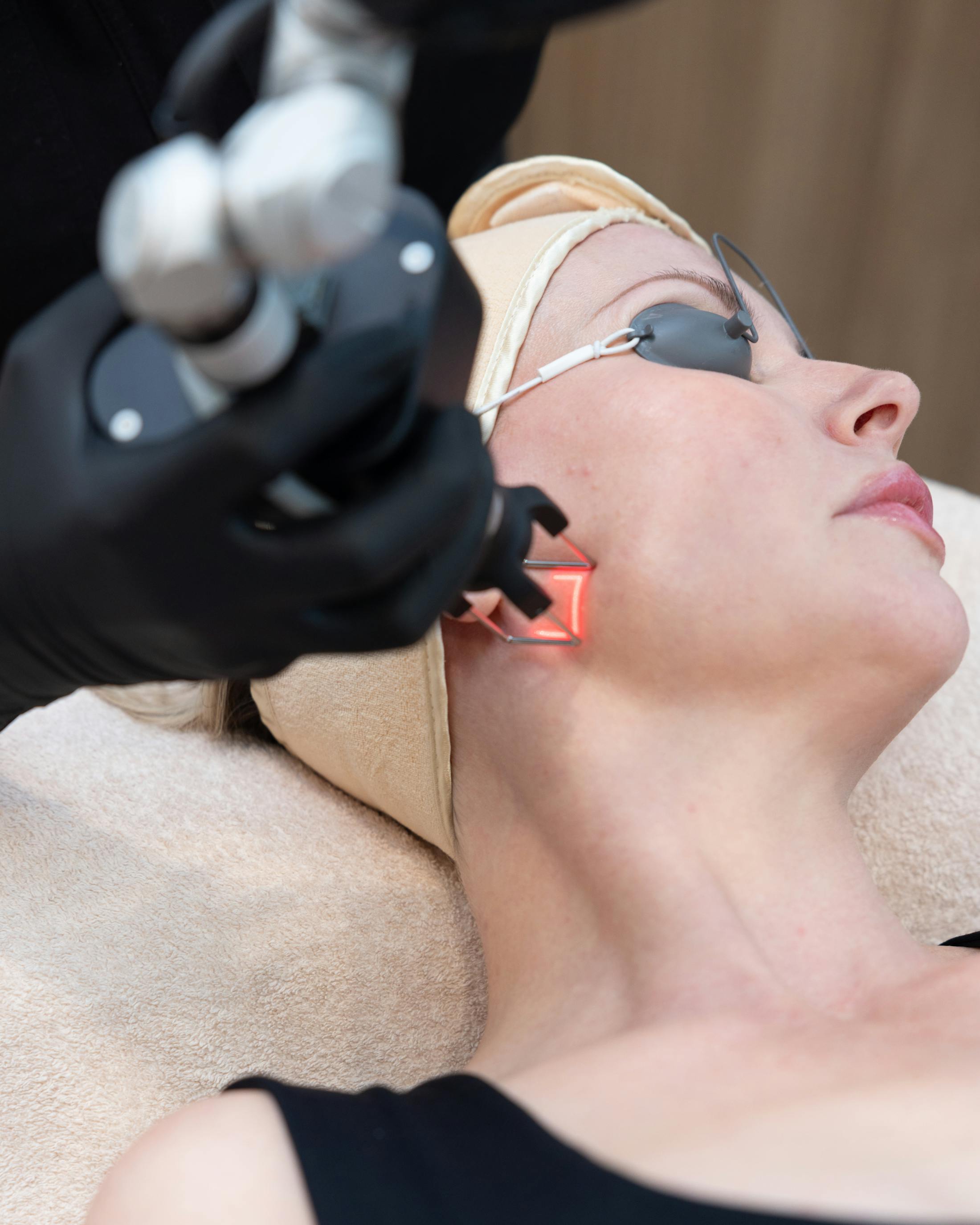 patient getting treated with a laser on her face