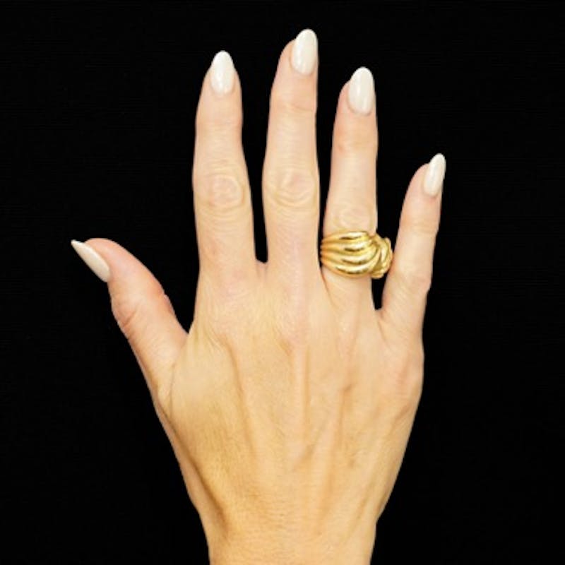 Alloclae-adipose Filler Before & After Gallery - Patient 272753 - Image 1