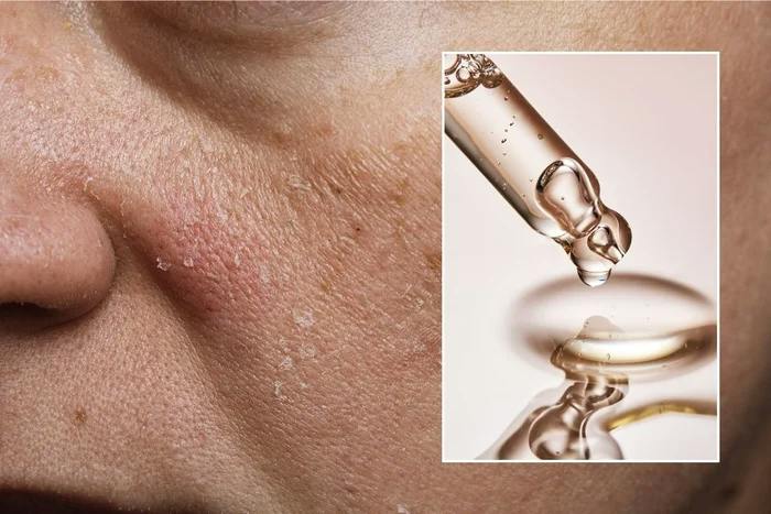 Two skin care routines that will shrink pores and smooth out the skin, according to a nurses