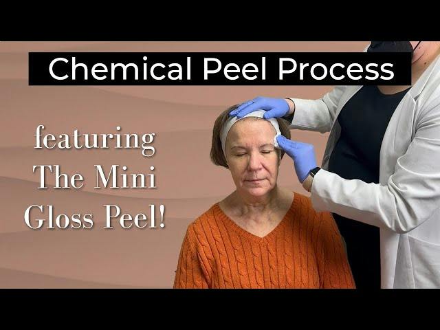 Woman getting a chemical peel
