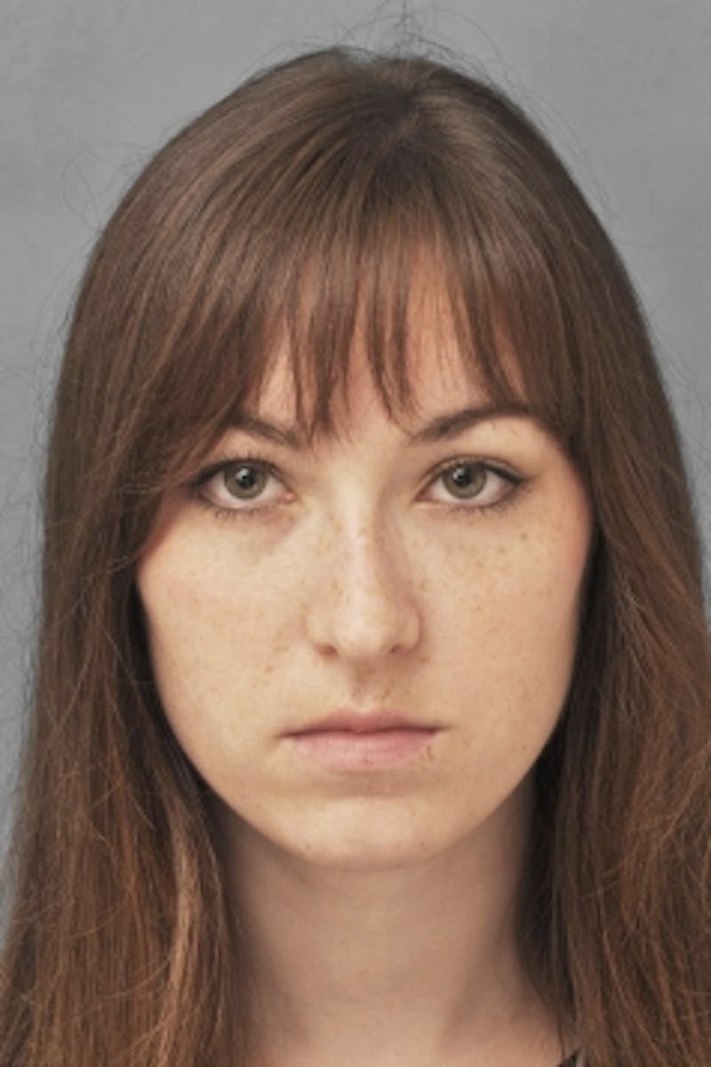 Rhinoplasty Before & After Gallery - Patient 206929 - Image 1