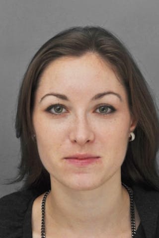 Rhinoplasty Before & After Gallery - Patient 206929 - Image 4