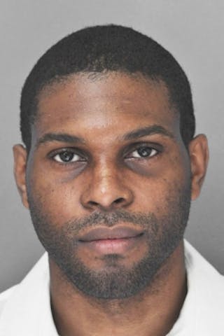 Rhinoplasty Before & After Gallery - Patient 872659 - Image 4