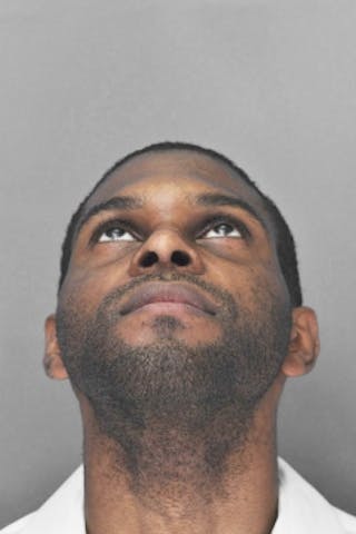 Rhinoplasty Before & After Gallery - Patient 872659 - Image 6