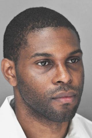 Rhinoplasty Before & After Gallery - Patient 872659 - Image 10