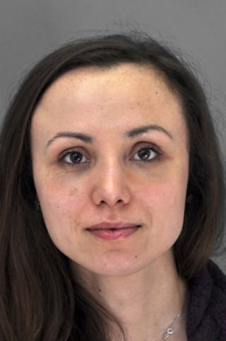 Rhinoplasty Before & After Gallery - Patient 292027 - Image 4