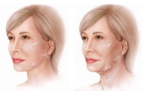 patient results