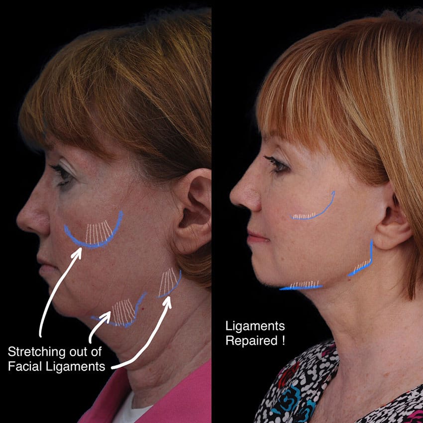 patient results