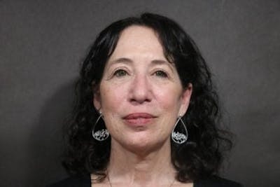 Facelift Before & After Gallery - Patient 233130 - Image 2