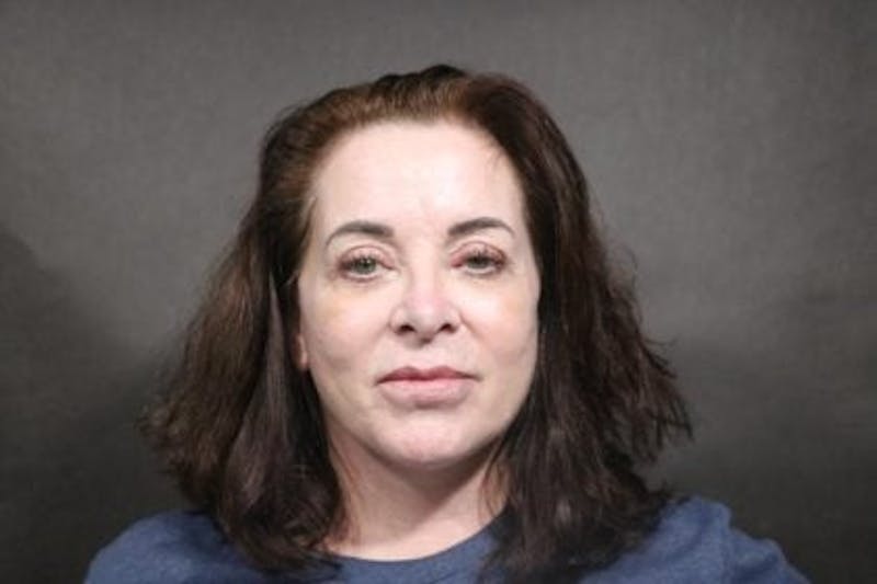 Facelift Before & After Gallery - Patient 163254 - Image 4