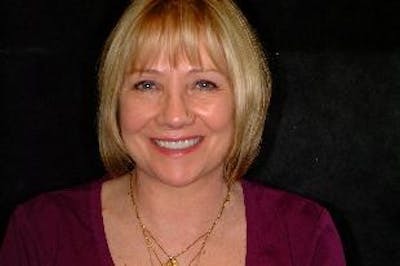 Facelift Before & After Gallery - Patient 276114 - Image 2