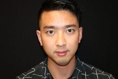 Chin Implants Before & After Gallery - Patient 429454 - Image 2
