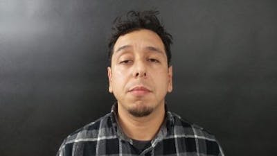 Male Otoplasty Before & After Gallery - Patient 204107 - Image 2