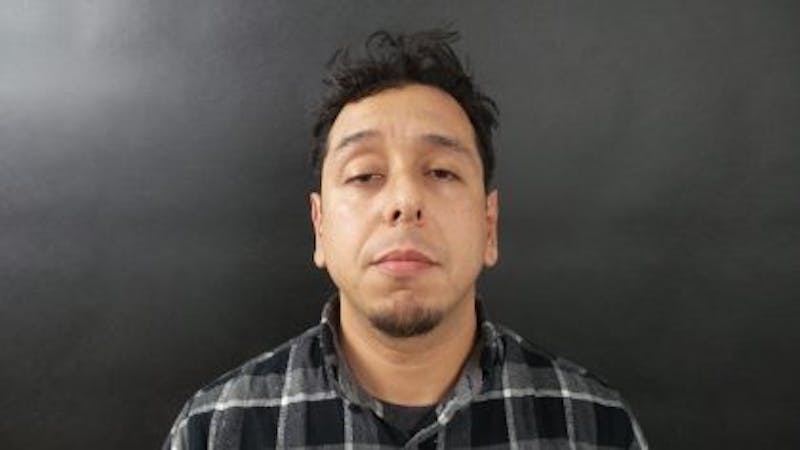 Male Otoplasty Before & After Gallery - Patient 204107 - Image 2