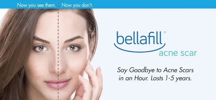 bellafill banner