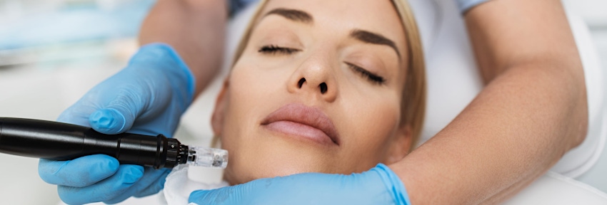 woman getting micro needling procedure done