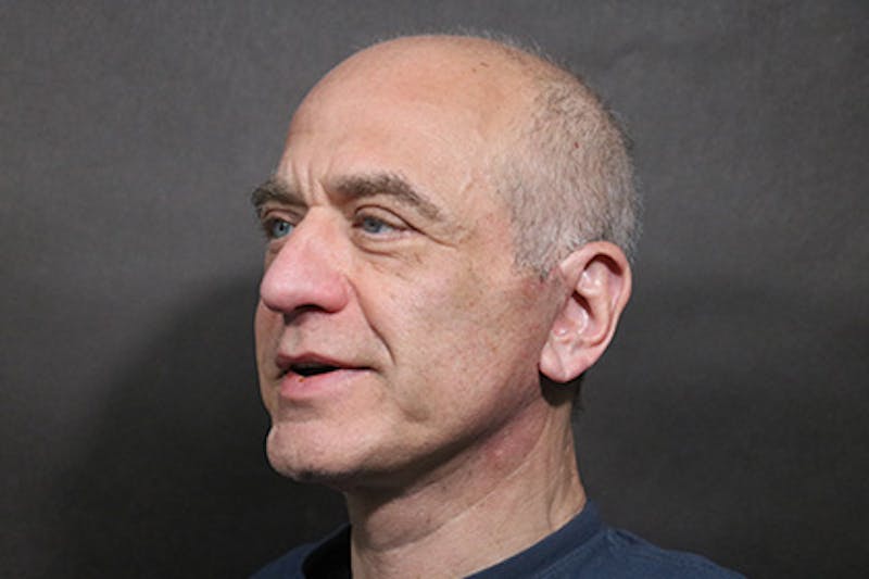 Facelift Before & After Gallery - Patient 427338 - Image 2