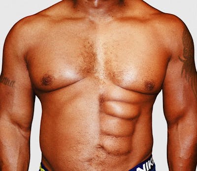 Welcome to the era of the fake six-pack