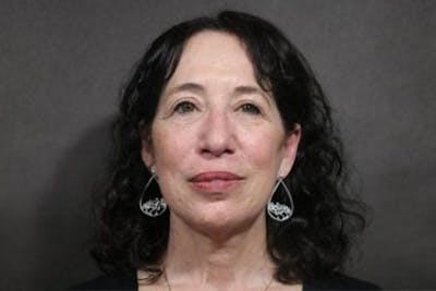 Facelift Before & After Gallery - Patient 233130 - Image 2