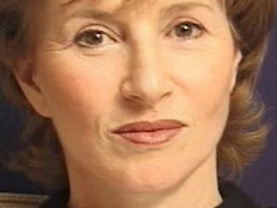 Facelift Before & After Gallery - Patient 326003 - Image 2