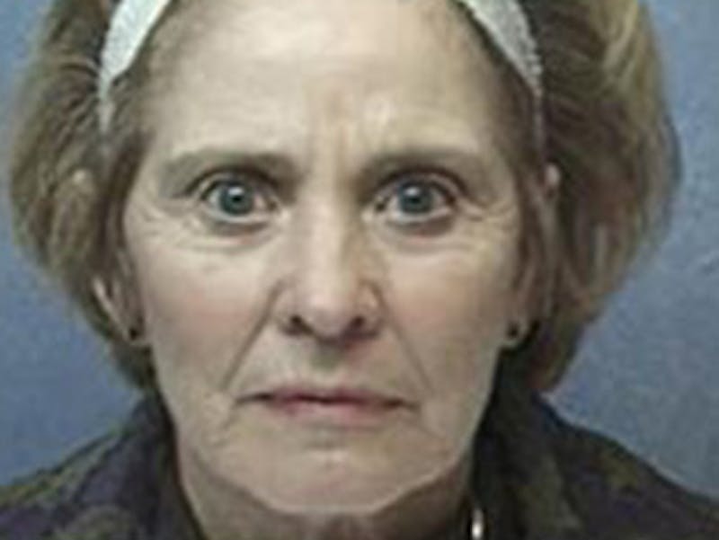 Facelift Before & After Gallery - Patient 152029 - Image 1