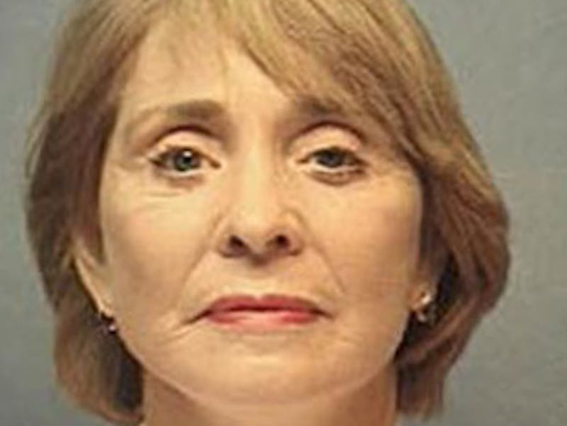 Facelift Before & After Gallery - Patient 152029 - Image 2