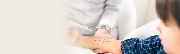doctor conducting an allergy test on a child