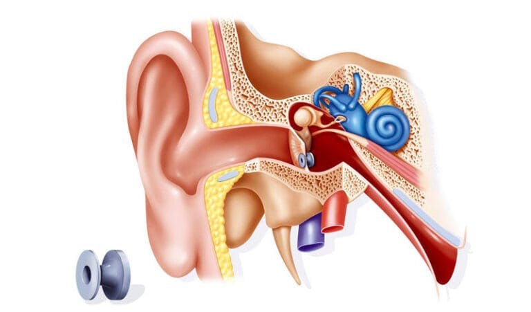 ear grommet
