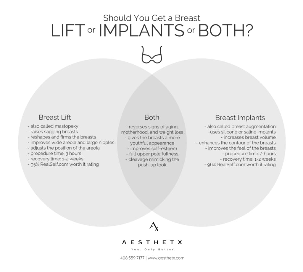 Comparison of breast lifts and breast implants