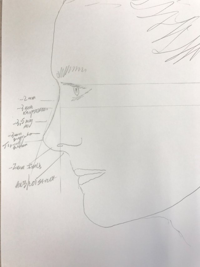 Drawing explaining nose structure