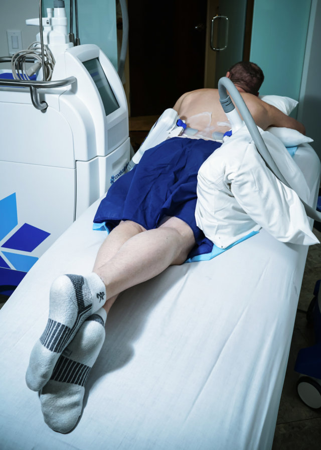 Person recieving CoolSculpting treatment