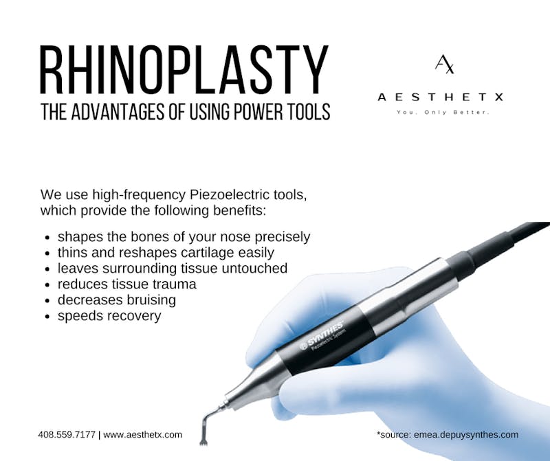 Rhinoplasty with power tools